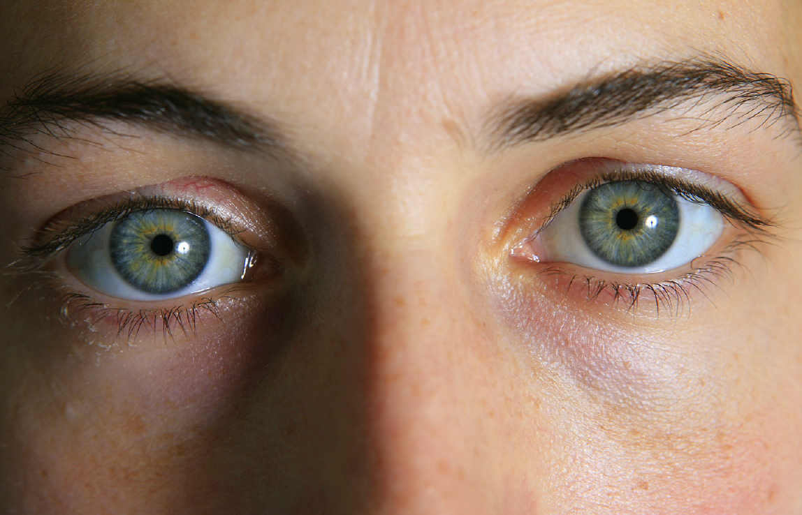 Augenpaar