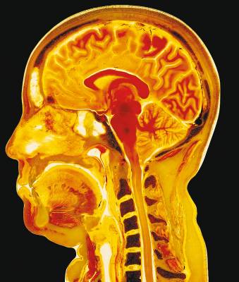 Sch�del-R�ntgenbild