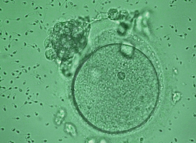 Sperma.Eizelle